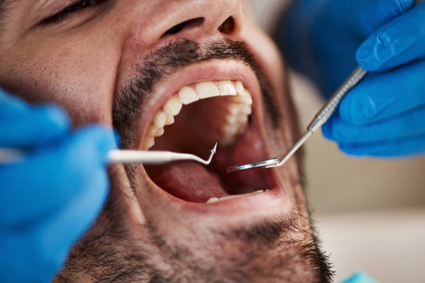 Best Chipped Tooth Repair Near Me  in Long Beach, WA