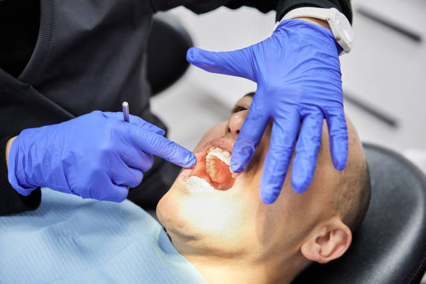Teeth Whitening in WA