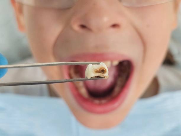 Best Tooth Infection Emergency Dentist  in Long Beach, WA