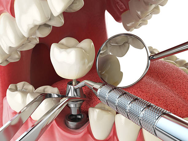 Best Emergency Tooth Extraction  in Long Beach, WA